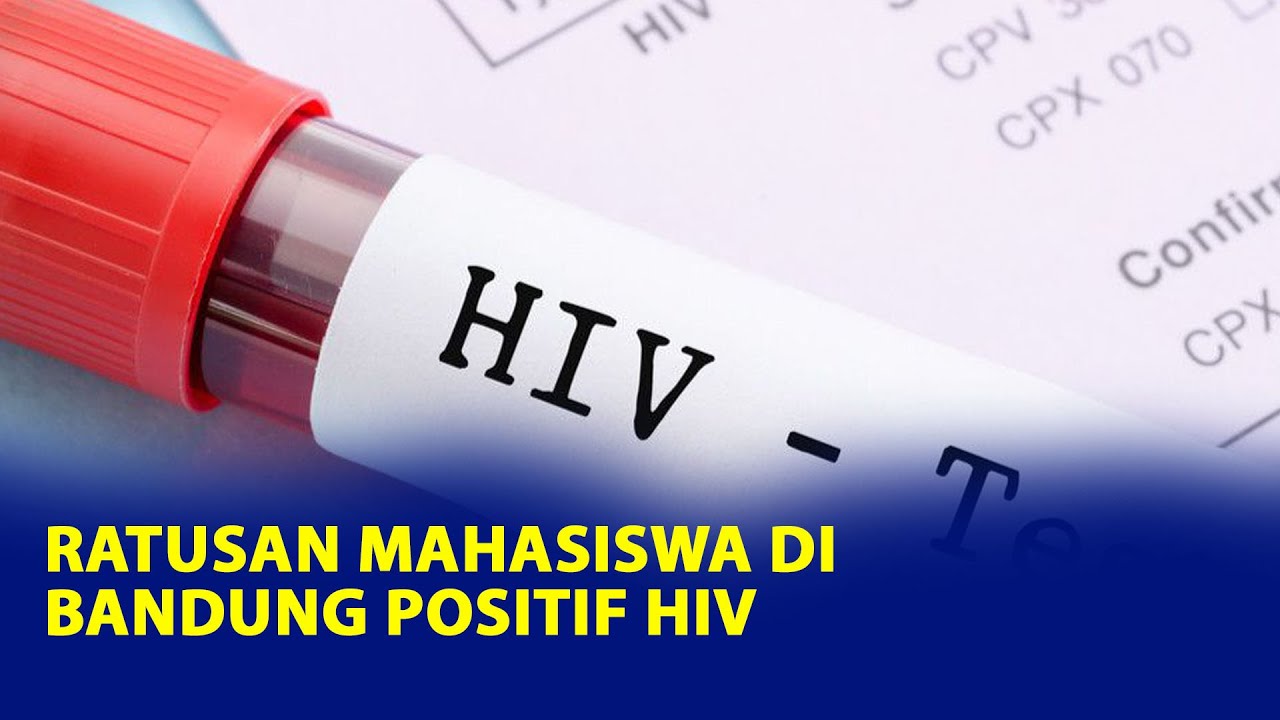 Ratusan Mahasiswa Di Bandung Positif HIV, Waspadai Gejalanya Berikut Ini