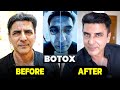 எப்படி இருந்த நான் இப்படி ஆகிட்டேன் 🫢| Full Face Botox 