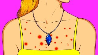 Comment Savoir Si tu es Allergique Aux Bijoux 