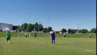 Goalkeeper mistakes face for ball
