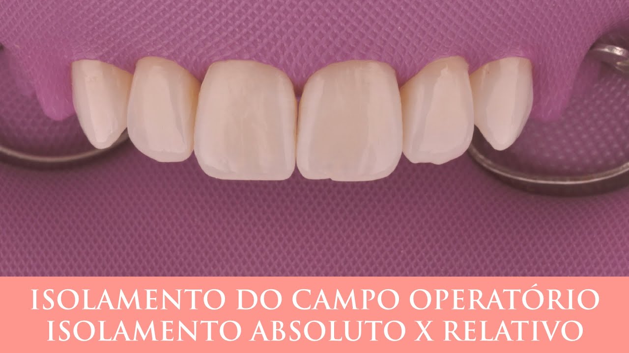 Isolamento do campo operatório. Absoluto X Relativo