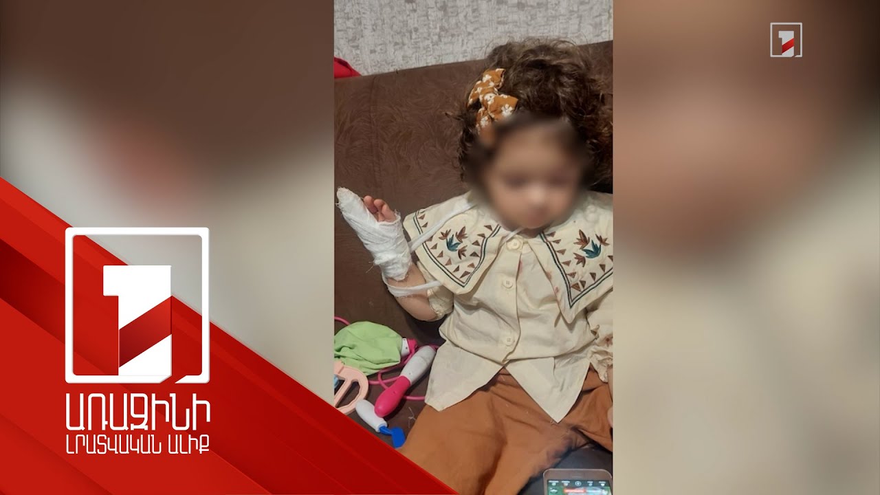 Երեխաների ժամանցի վայրի անվտանգությունն ու վնասի հնարավոր փոխհատուցման կարգը