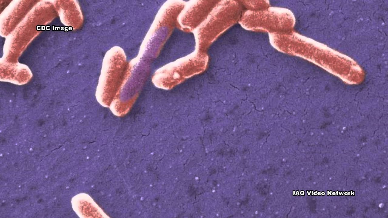 Carbapenem-Resistant Enterobacteriaceae (CRE)
