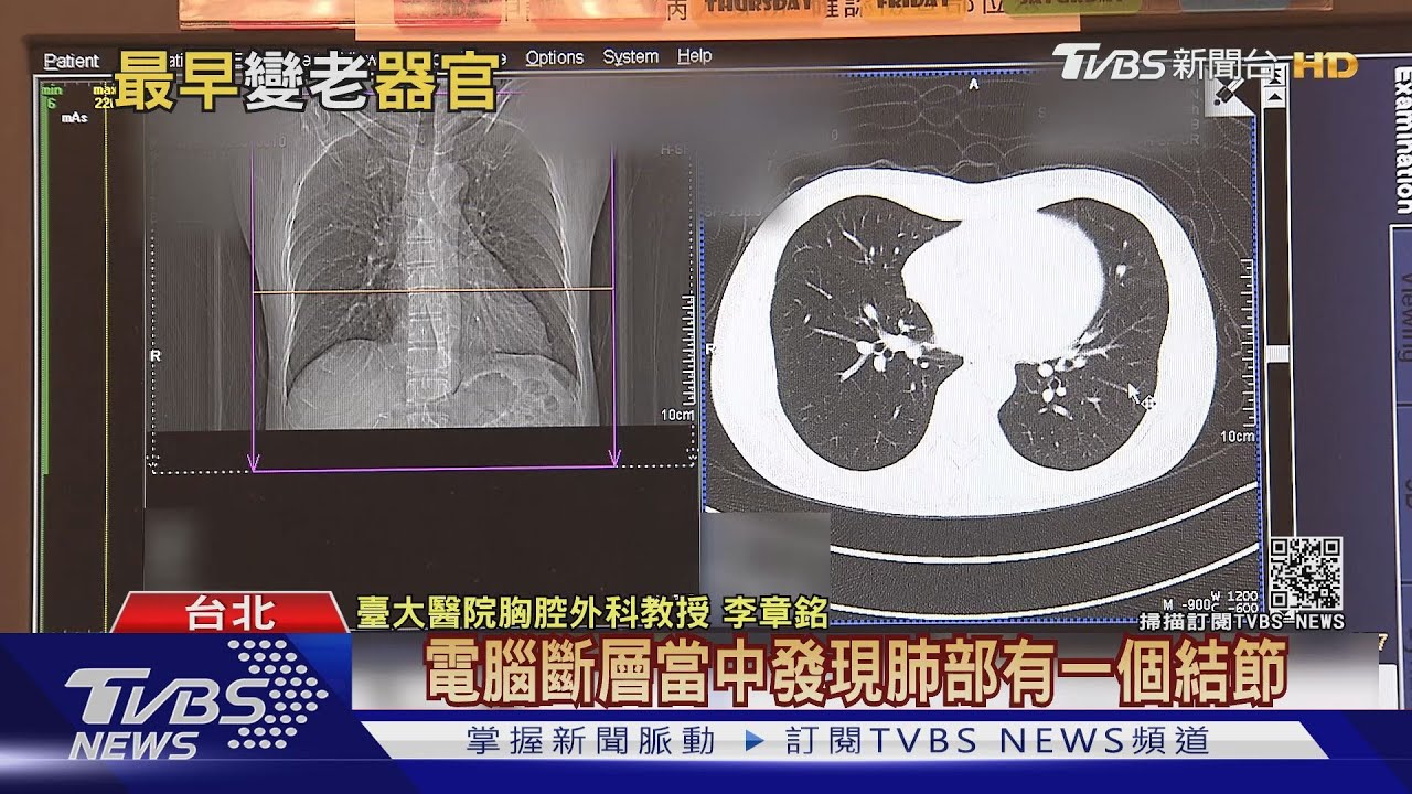 身體「這個器官」最早開始變老　若輕忽「罹癌風險」高