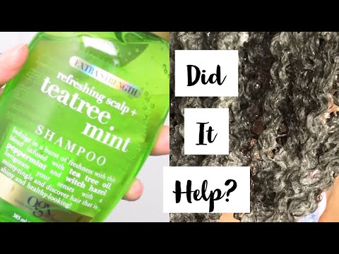 I Tried This For My Itchy Scalp! | OGX Refreshing...
