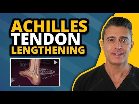 Achilles Tendon Lengthening Explained