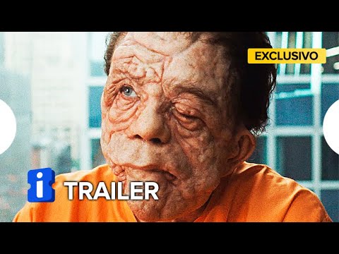 Um Homem Diferente - Trailer