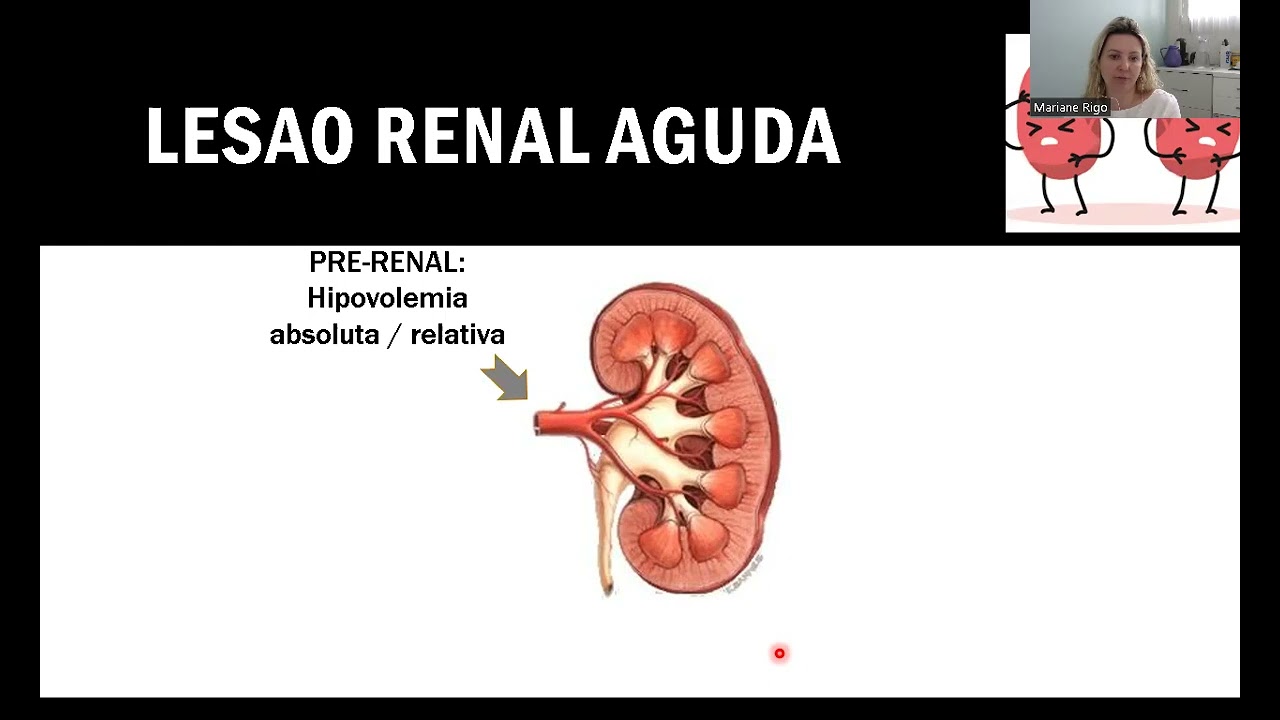 Injuria renal aguda