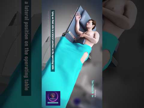 Total Left Hip Replacement Surgery #shorts #hipreplacement