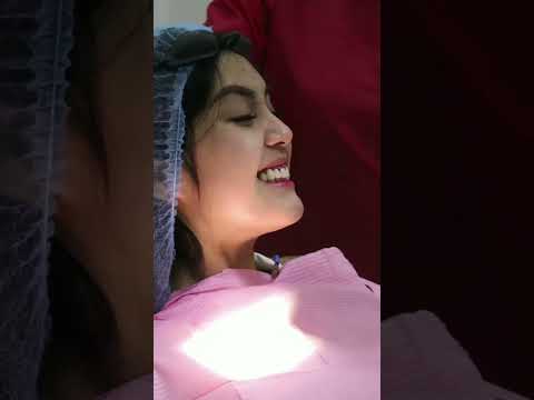 Gummy Smile No More! #DrRFD #shorts