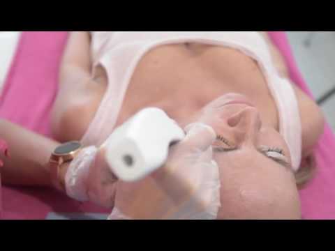 Plexr alternatywa dla chirurgii plastycznej lek.med Katarzyna Grudzień LiftMed