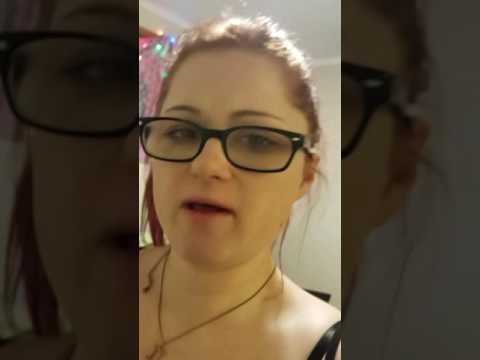 Post interosseous nerve compression syndrome-- finger drop