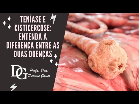 116. Teníase e Cisticercose: Entenda a Morfologia do Parasita Causador e sua Transmissão  (Parte 1)