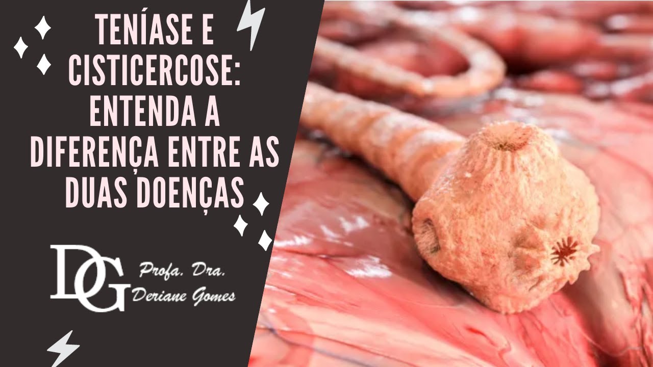 116. Teníase e Cisticercose: Entenda a Morfologia do Parasita Causador e sua Transmissão  (Parte 1)