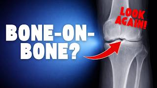Knee Pain? This Is What Doctors Are Missing