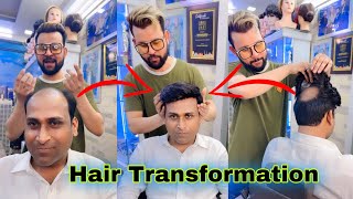 Hair Patch Live Work With RIZY | Hair Transformation | 9599858612 |