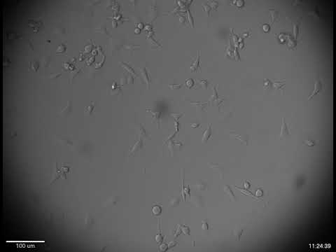 Time lapse microscopy of HEYA8 ovarian cancer cells