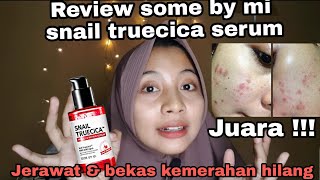 Download lagu REVIEW JUJUR SOME BY MI SNAIL TRUECICA SERUM MENGHILANGKAN BEKAS JERAWAT | Dellayustra mp3