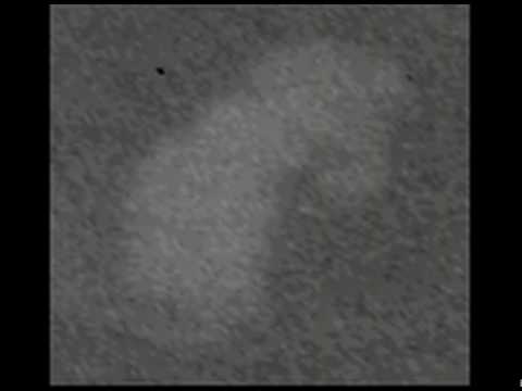 Imagen de previsualización de YouTube