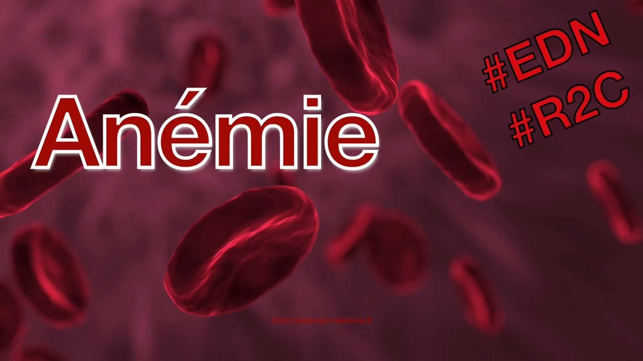 Anémie - Révisez l'item 213 de l'EDN selon la R2C