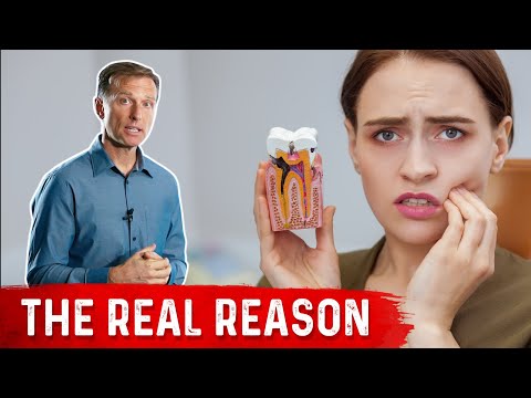 Cavities: The 2nd Most Common Disease Worldwide...but Why?