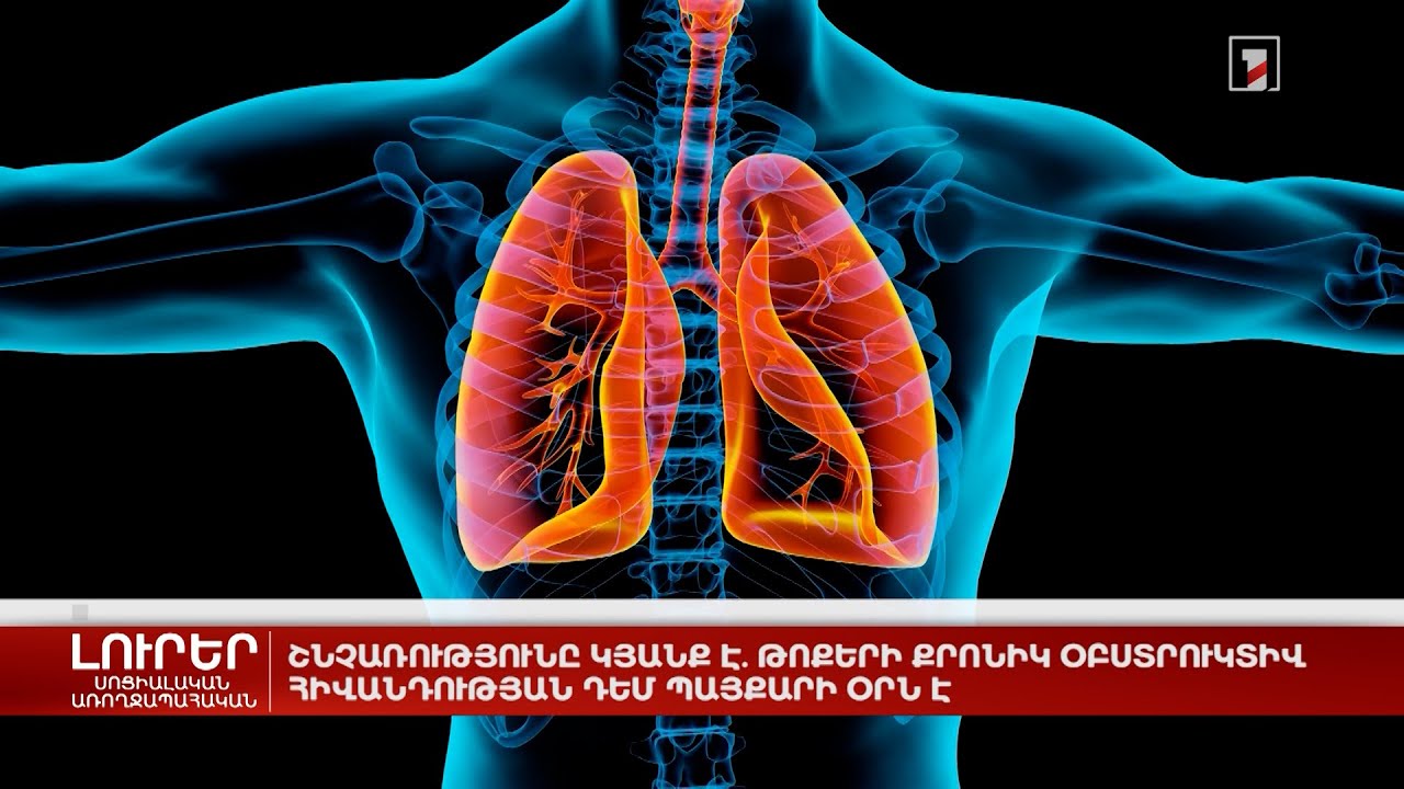 Շնչառությունը կյանք է. թոքերի քրոնիկ օբստրուկտիվ հիվանդության դեմ պայքարի օրն է