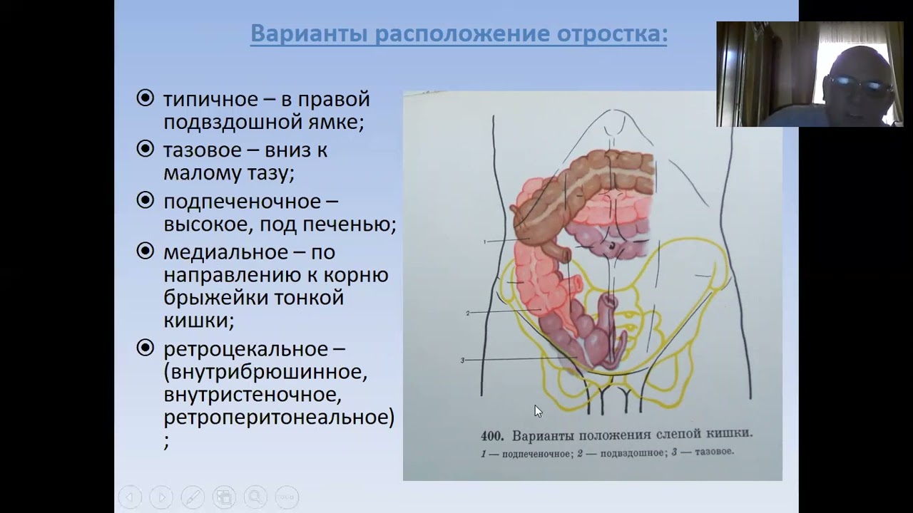 Острый аппендицит и его осложнения
