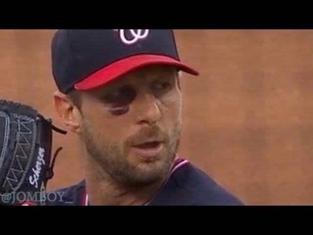 Max Scherzer strikes out ten batters with a broken nose, a breakdown