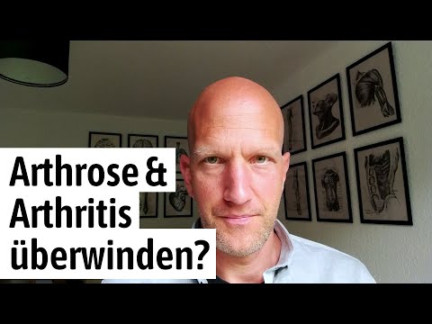 Arthrose, Arthritis und Gelenkschmerzen behandeln und lindern ohne Medikamente