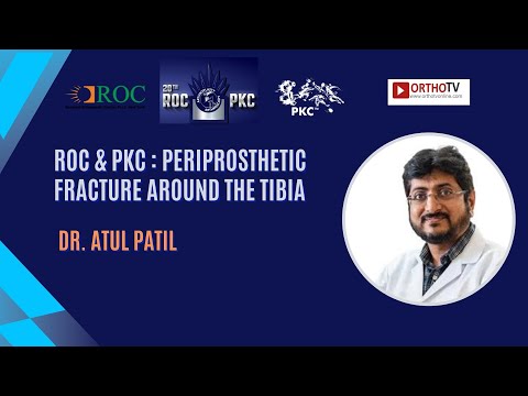 ROC &amp; PKC : Periprosthetic Fracture Around the Tibia - Dr. Atul Patil