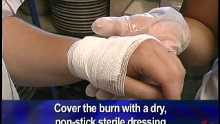 First Aid for Burns with Nick Rondinelli