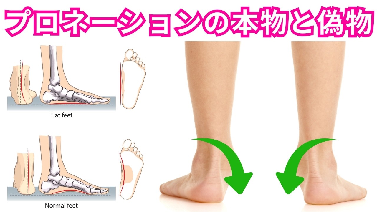 「足のプロネーション」の本物と偽物の明確な１つの違い！