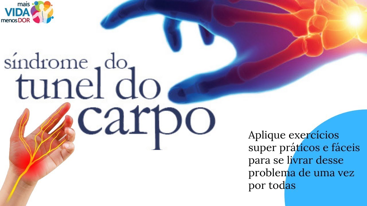 Exercícios para tratar Síndrome do Túnel do Carpo