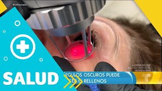 Descubre los mejores tratamientos contra las ojeras | Un Nuevo Día