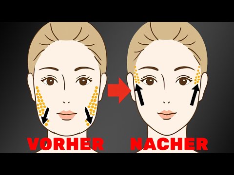 LOSE FACIAL FAT & TIGHTEN – with these exercises (without surgery!)