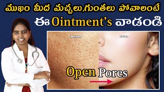 How to Remove Open Pores | Top 2 Ointment