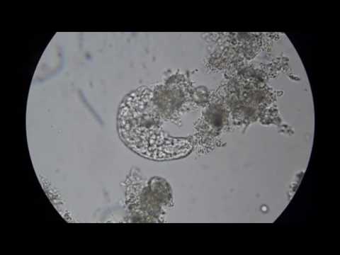 Youngg P - Volshebnaya Shkatulka / Волшебная Шкатулка