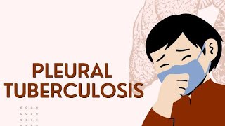 PLEURAL TUBERCULOSIS | EXTRAPULMONARY TB