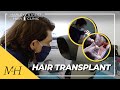 Watching A Hair Transplant At The Harley Street Hair Clinic