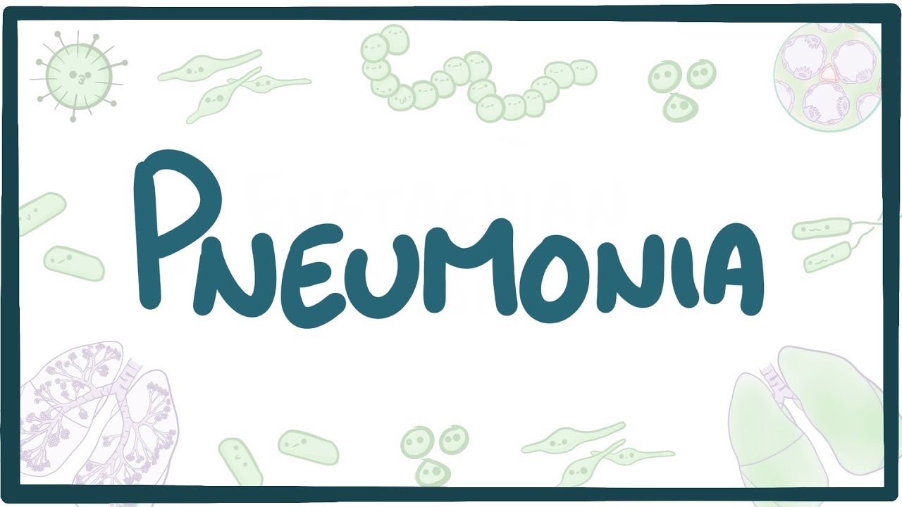 Breathless: A Complete Guide to Understanding Pneumonia, Beauty Vigour