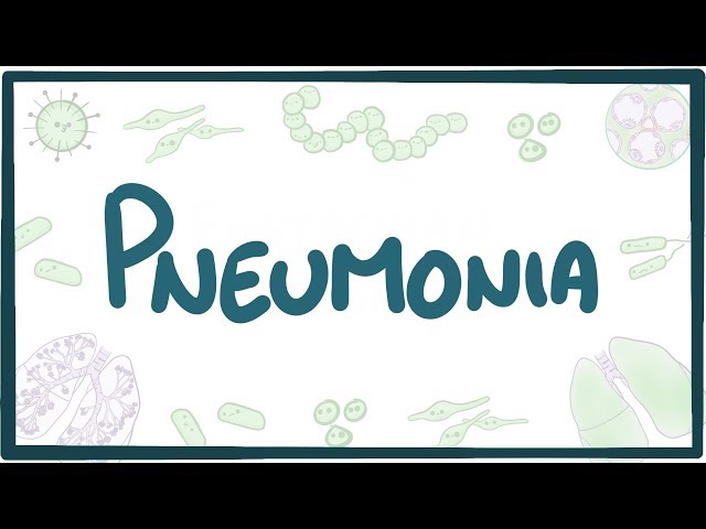 Video Uitspraak van pneumoniae in Engels