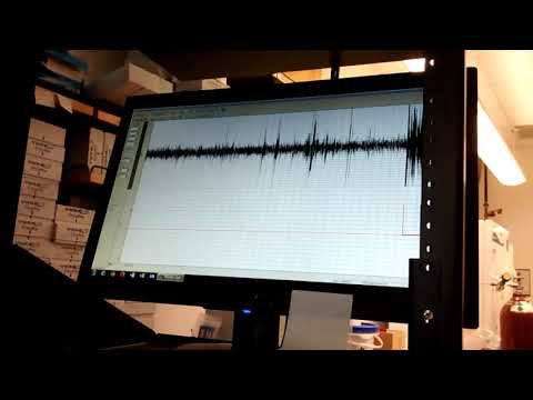 Practice Single Sensillum Response
