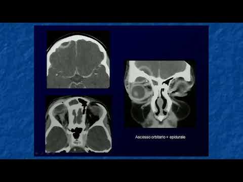 Dolore alla schiena tra le scapole al centro ICD-10 artrosi piccole articolazioni delle mani