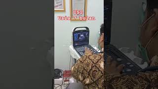 Download lagu USG usia kehamilan 7 bulan #usg3d #ibuhamil #ibu #viralshort mp3 Download lagu USG usia kehamilan 7 bulan #usg3d #ibuhamil #ibu #viralshort mp3