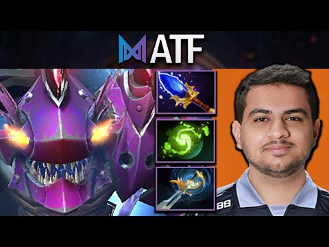 TI13 - Slark Dota 2 Gameplay Nigma.ATF with Midas - Lima Major