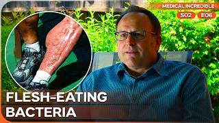 A Simple Soccer Injury Turned Into a Flesh-Eating Nightmare | Medical Incredible