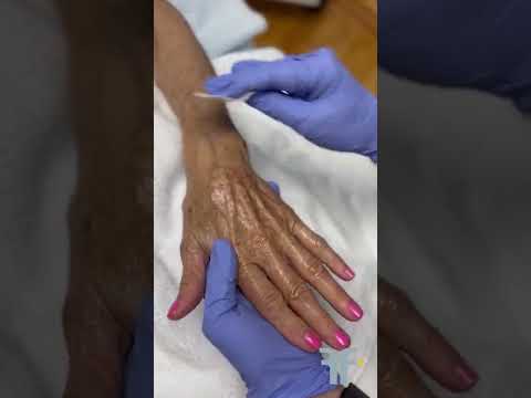 Hand Peel Video
