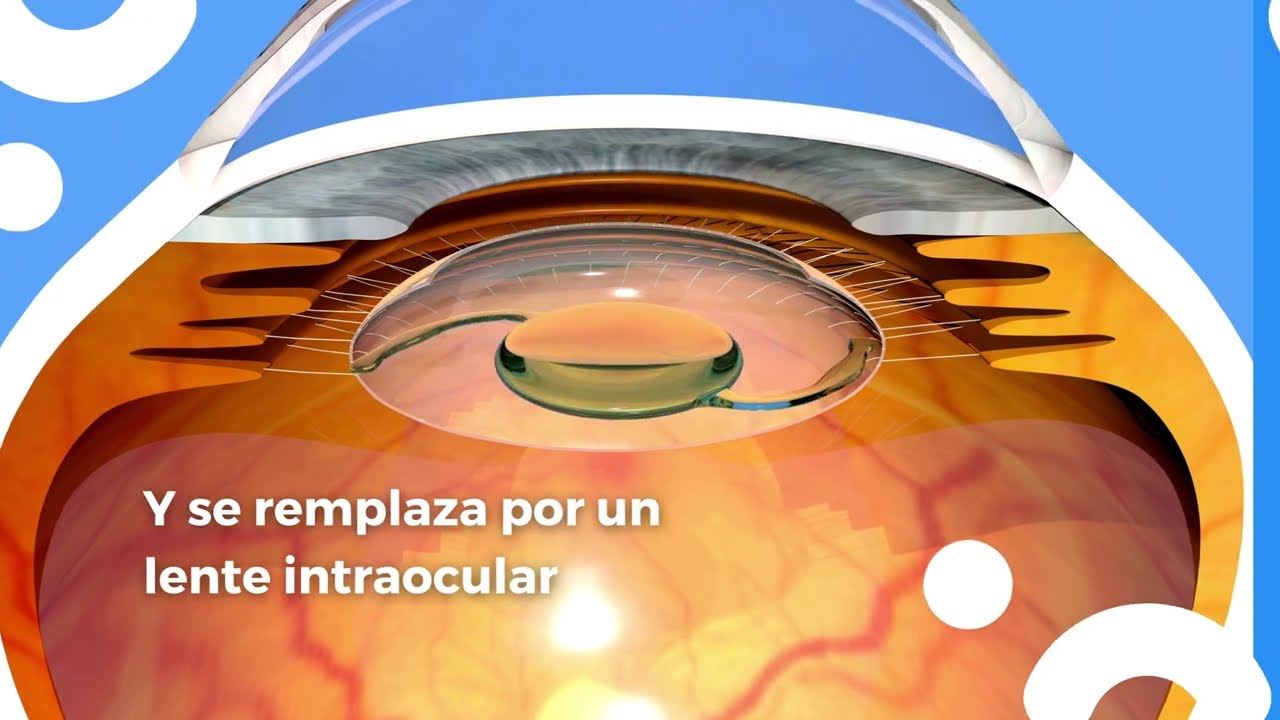 Jorge Guevara Chipolini-13