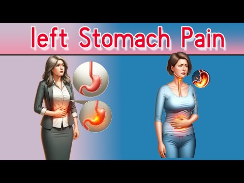 Upper Left Stomach Pain: TOP 9 Causes