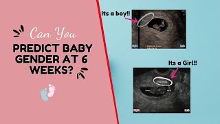 Can You Detect Baby's Gender at 6-8 Weeks Scan  Boy or Girl  The Ramzi Theory Gender Prediction